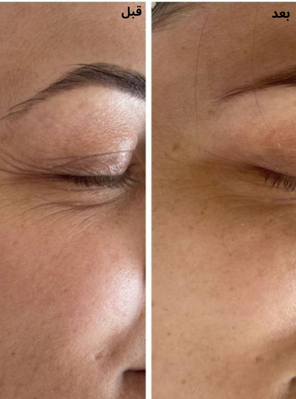 كريم العيون لمحاربة الهالات السوداء ,الانتفاخات والتجاعيد بتقنية الضوء الأحمر المتقدمة - ENAYA™