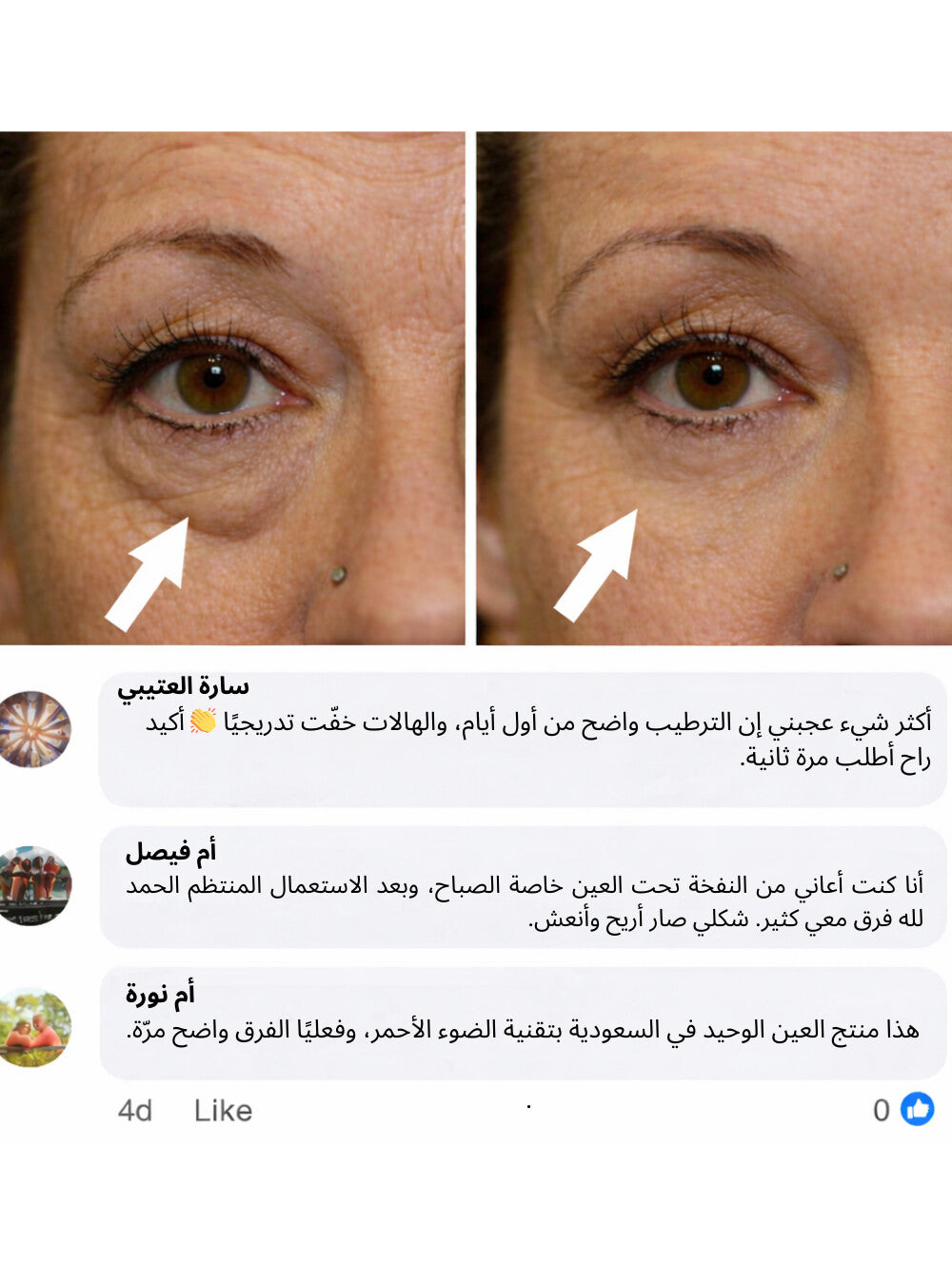 كريم العيون لمحاربة الهالات السوداء ,الانتفاخات والتجاعيد بتقنية الضوء الأحمر المتقدمة - ENAYA™