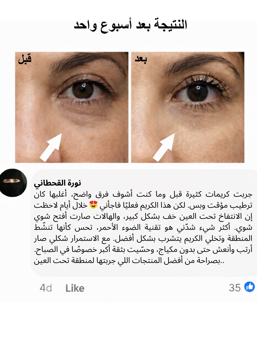 كريم العيون لمحاربة الهالات السوداء ,الانتفاخات والتجاعيد بتقنية الضوء الأحمر المتقدمة - ENAYA™